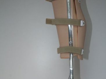 Orthèse tibio-pédieuse de décharge avec appui sous-rotulien (PTB), avec chaussure